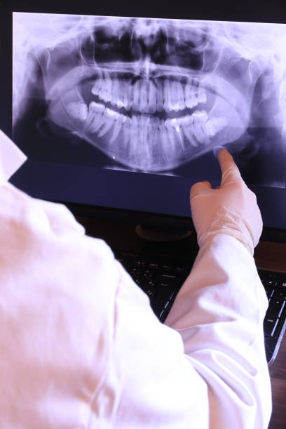 Best Dental Abscess Treatment in Wilsonville, AL