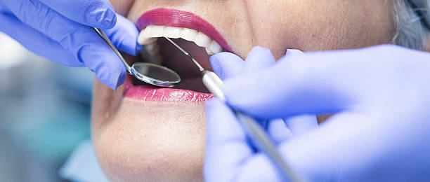 Best Emergency Dental Care for Sports Injuries in Wilsonville, AL