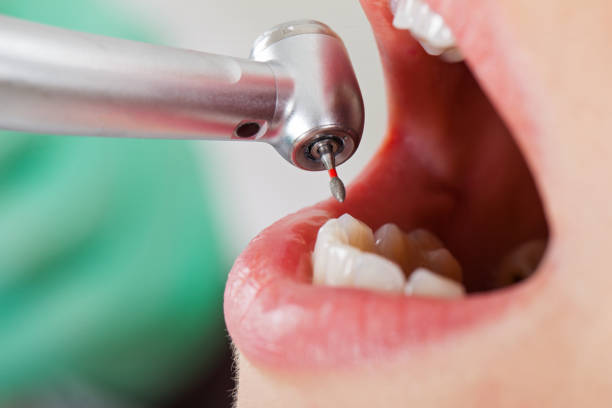 Best After-Hours Dental Care in Wilsonville, AL